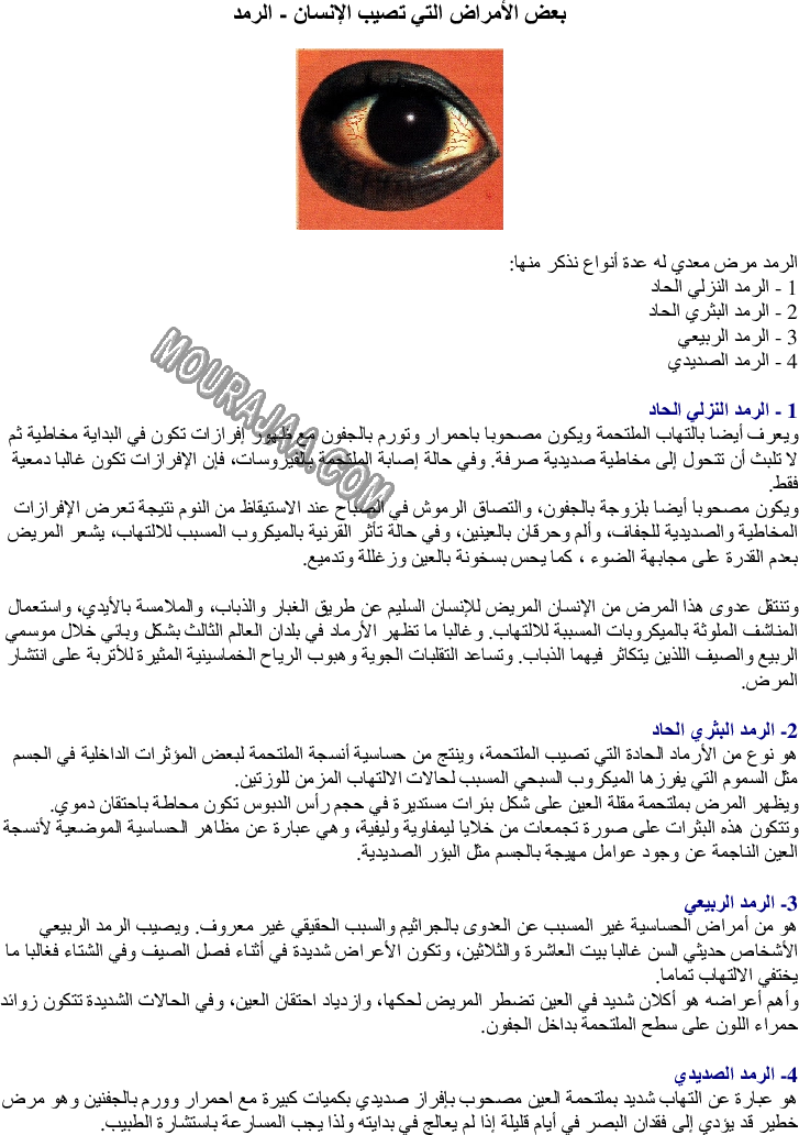 بعض الأمراض التي تصيب الإنسان - الرمد